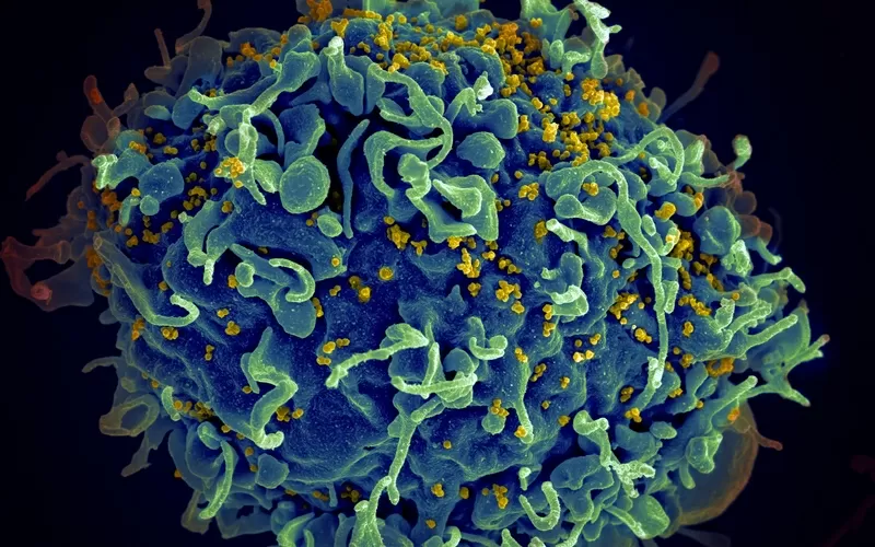 HIV: Cause, Trasmissione e Terapie